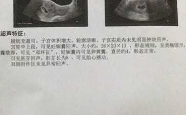 郑州做一次试管婴儿要多少费用，郑州试管花费明细表-助孕供卵代生